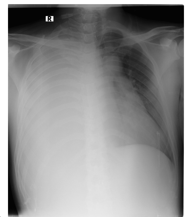 3 foto berikut adalah foto klinis dari 3 pasien berbeda yang memiliki 1 karateristik yang sama: perokok
