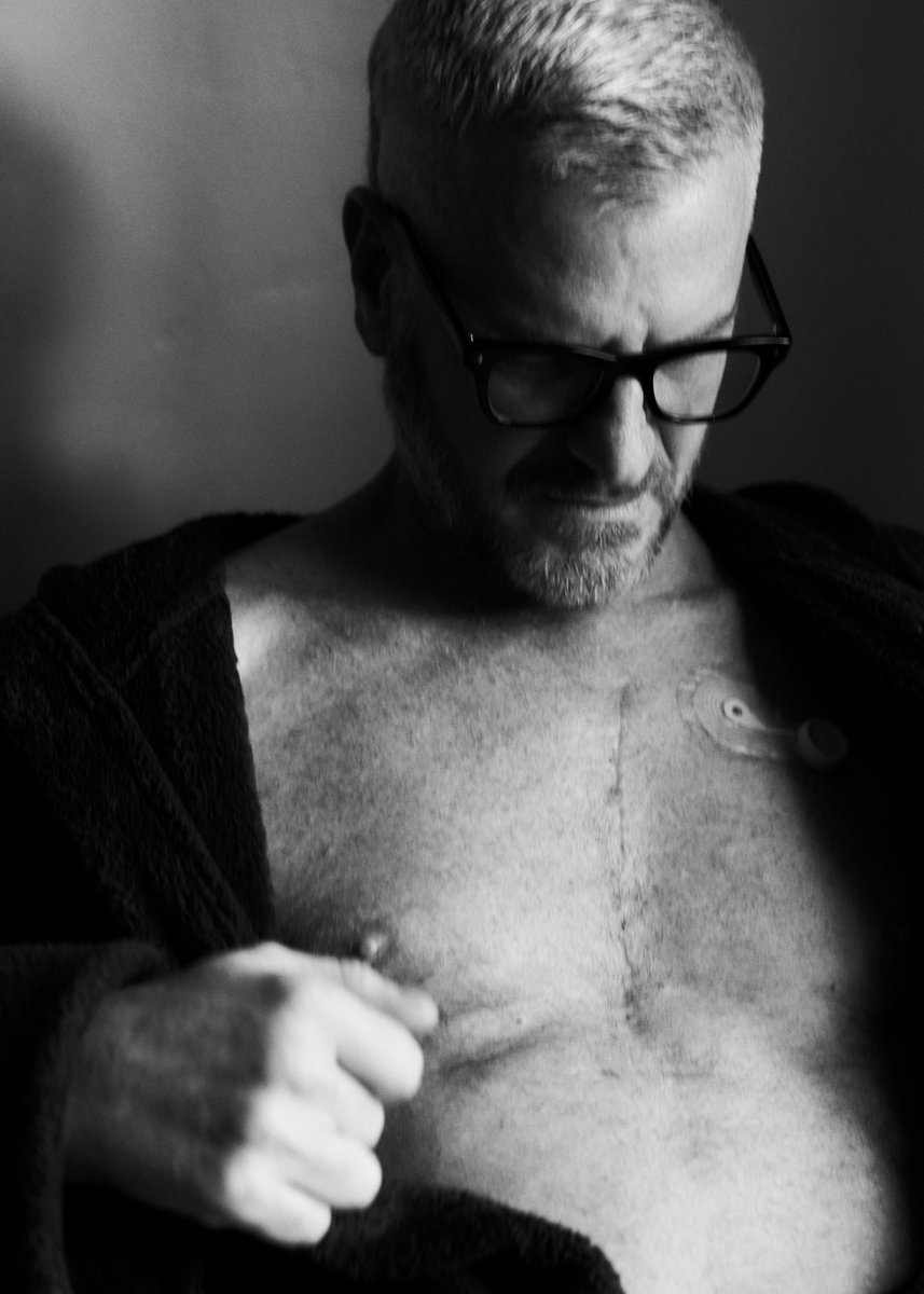 Marc Malkin (@marcmalkin) on Twitter photo A couple of weeks ago, my friend and photographer <a href="/ShayanAsgharnia/">Shayan Asgharnia</a> arrived at my apartment on a sunny Sunday afternoon. He was there to shoot me and my scar, the seven-inch forever marker of my open heart surgery. Two of these portraits now accompany an essay I wrote for @variety A couple of weeks ago, my friend and photographer <a href="/ShayanAsgharnia/">Shayan Asgharnia</a> arrived at my apartment on a sunny Sunday afternoon. He was there to shoot me and my scar, the seven-inch forever marker of my open heart surgery. Two of these portraits now accompany an essay I wrote for @variety