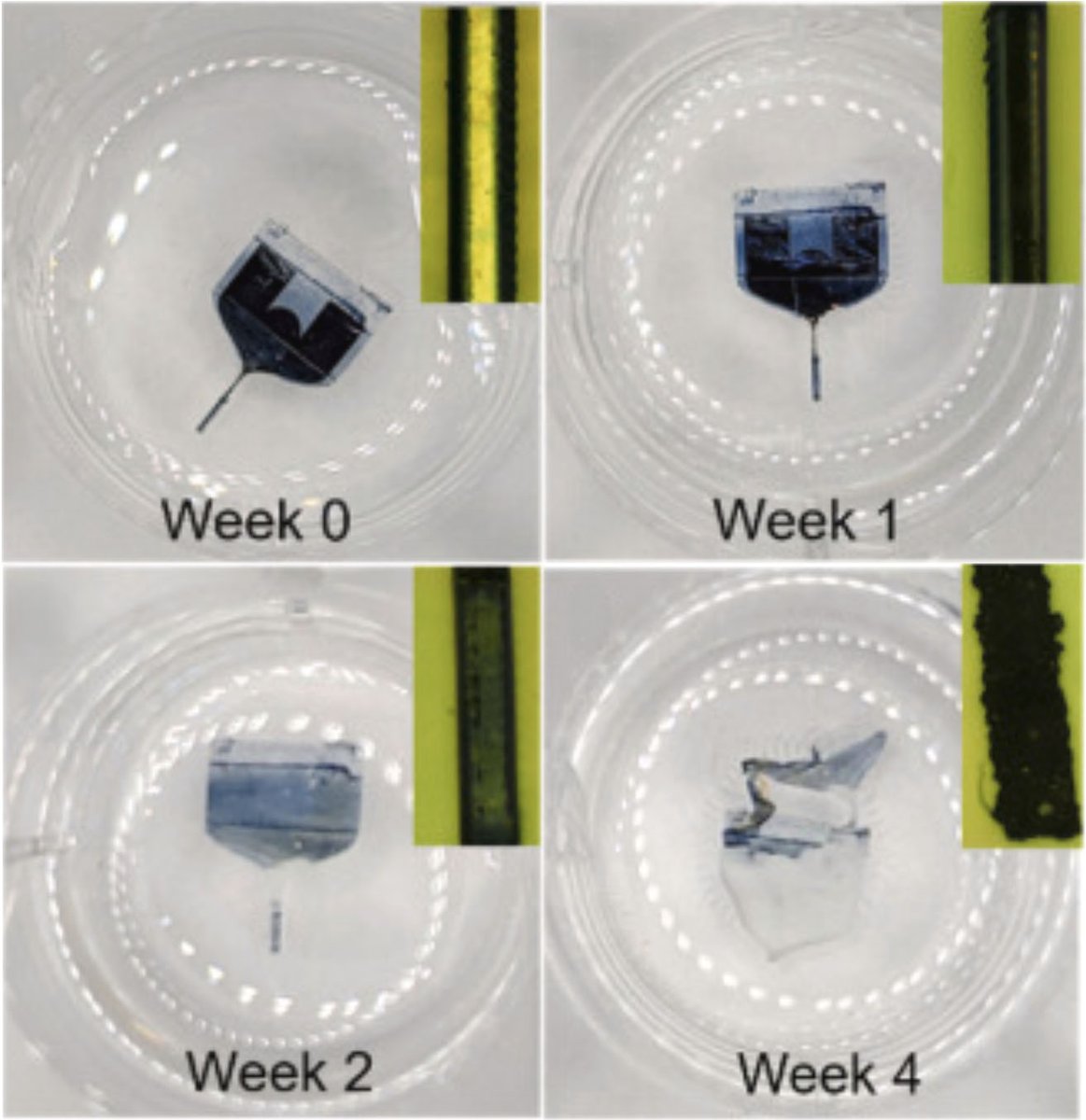 Signals (@signalsblogs) on Twitter photo Researchers from <a href="/UofT/">University of Toronto</a> have developed a biodegradable electrode to treat stroke patients. Tianhao Chen in the <a href="/CindiMorshead/">Cindi Morshead</a> lab and Hani Naguib's lab have discovered a possible way of treating neurological disorders. Read our blog post here: signalsblog.ca/biodegradable-… Researchers from <a href="/UofT/">University of Toronto</a> have developed a biodegradable electrode to treat stroke patients. Tianhao Chen in the <a href="/CindiMorshead/">Cindi Morshead</a> lab and Hani Naguib's lab have discovered a possible way of treating neurological disorders. Read our blog post here: signalsblog.ca/biodegradable-…