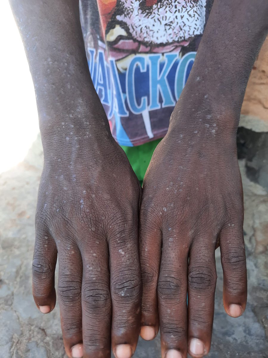 Center for Justice GEA (@cjgea) on Twitter photo #OwinoUhuru land must be cleaned. Our community must be restored. And those <a href="/NemaKenya/">NEMA Kenya</a> and <a href="/epzakenya/">Export Processing Zones Authority - Kenya</a> who failed to act—who allowed this poisoning to go unchecked—must be held accountable. Anything less is complicity. #JusticeForOwinoUhuru #NoMorePollutionKe #justicenowpaynow #OwinoUhuru land must be cleaned. Our community must be restored. And those <a href="/NemaKenya/">NEMA Kenya</a> and <a href="/epzakenya/">Export Processing Zones Authority - Kenya</a> who failed to act—who allowed this poisoning to go unchecked—must be held accountable. Anything less is complicity. #JusticeForOwinoUhuru #NoMorePollutionKe #justicenowpaynow