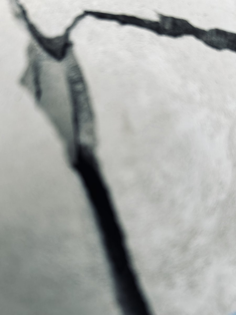 BCE #1147: Whore's Breath - Fracture

Sonically halfway between a WW2 bomber heading for a crash and electrical malfunction on a massive scale, we have two relentless tracks from the no mercy school of walling.

basementcorner.bandcamp.com/album/fracture