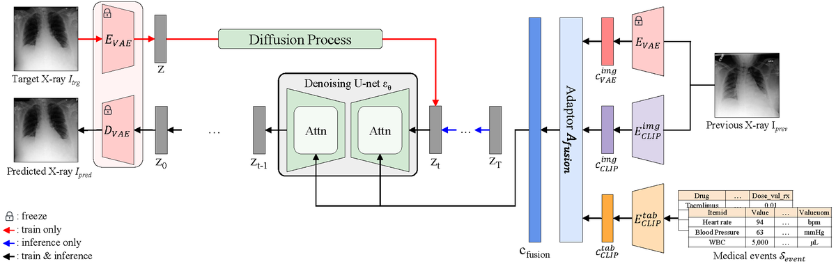 CHILconference's tweet image. Introducing EHRXDiff: A novel framework for predicting future chest X-rays using prior image and medical events, dynamically tracking disease progression.
Explore more: github.com/dek924/EHRXDiff
@daeunkyung @junukim01 
#CHIL2025papers
