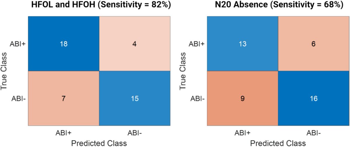 [Critical care EEG] Cao et al.: "Somatosensory evoked high-frequency oscillations can potentially improve early detection of acute brain injury in ECMO patients at the bedside." doi.org/10.1016/j.clin…
#ECMO: Extracorporeal Membrane Oxygenation