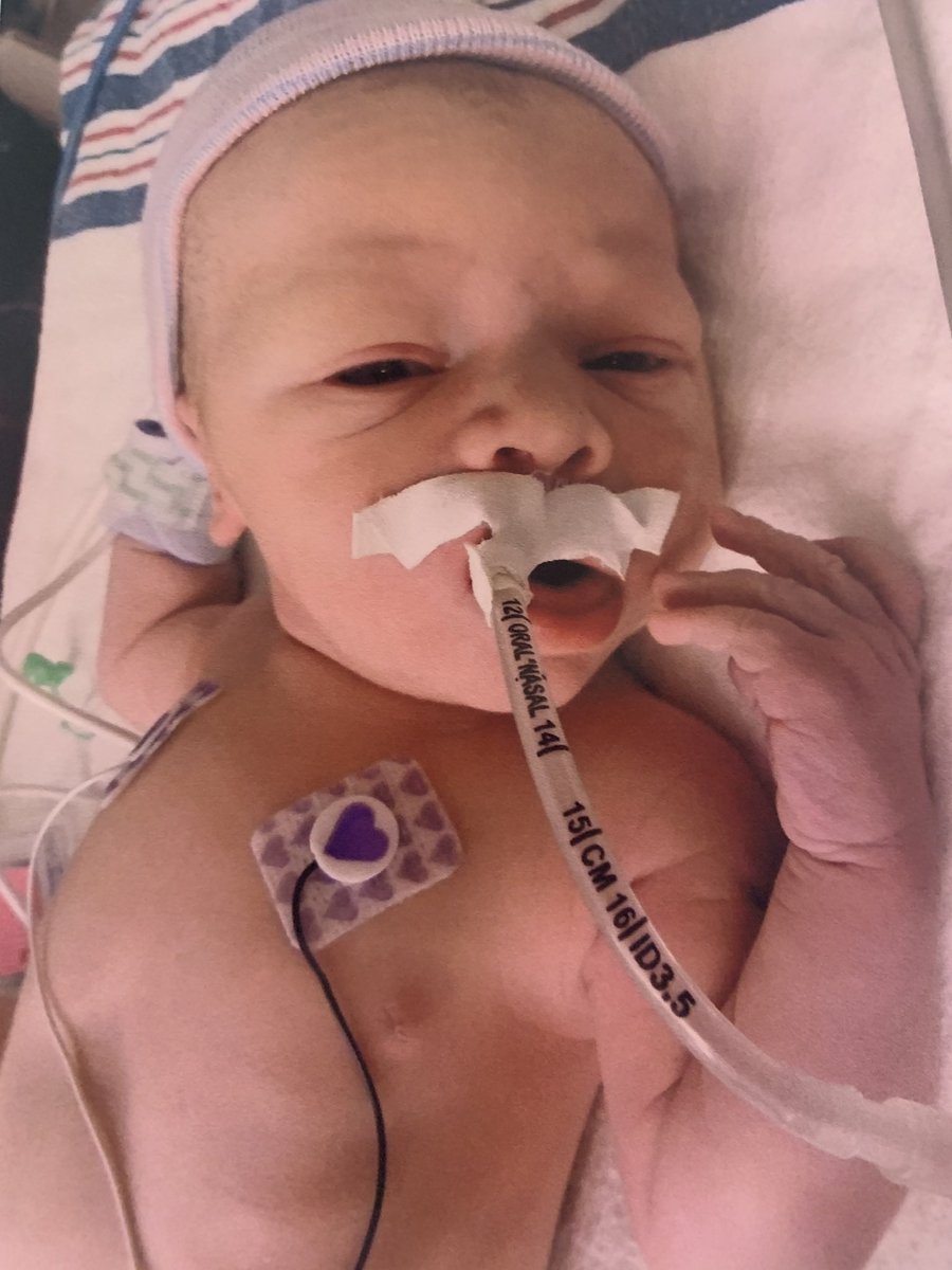 MikePhelps35's tweet image. Yes it’s only daycare graduation but 4.5 years ago i prayed to be able to see moments like this for this lil guy. But this lil guy has defied all odds and is absolutely kicking ass. Proud of my buddy moving onto preschool. #TeamMikai #CHDWarrior #Prouddad