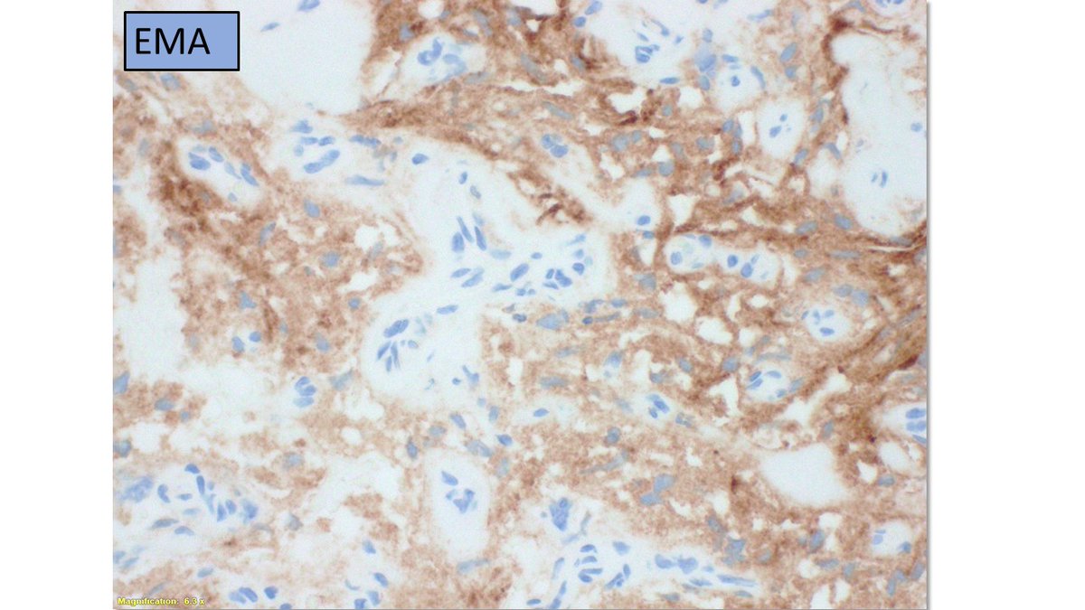 UTHealth Houston Pathology tweet media