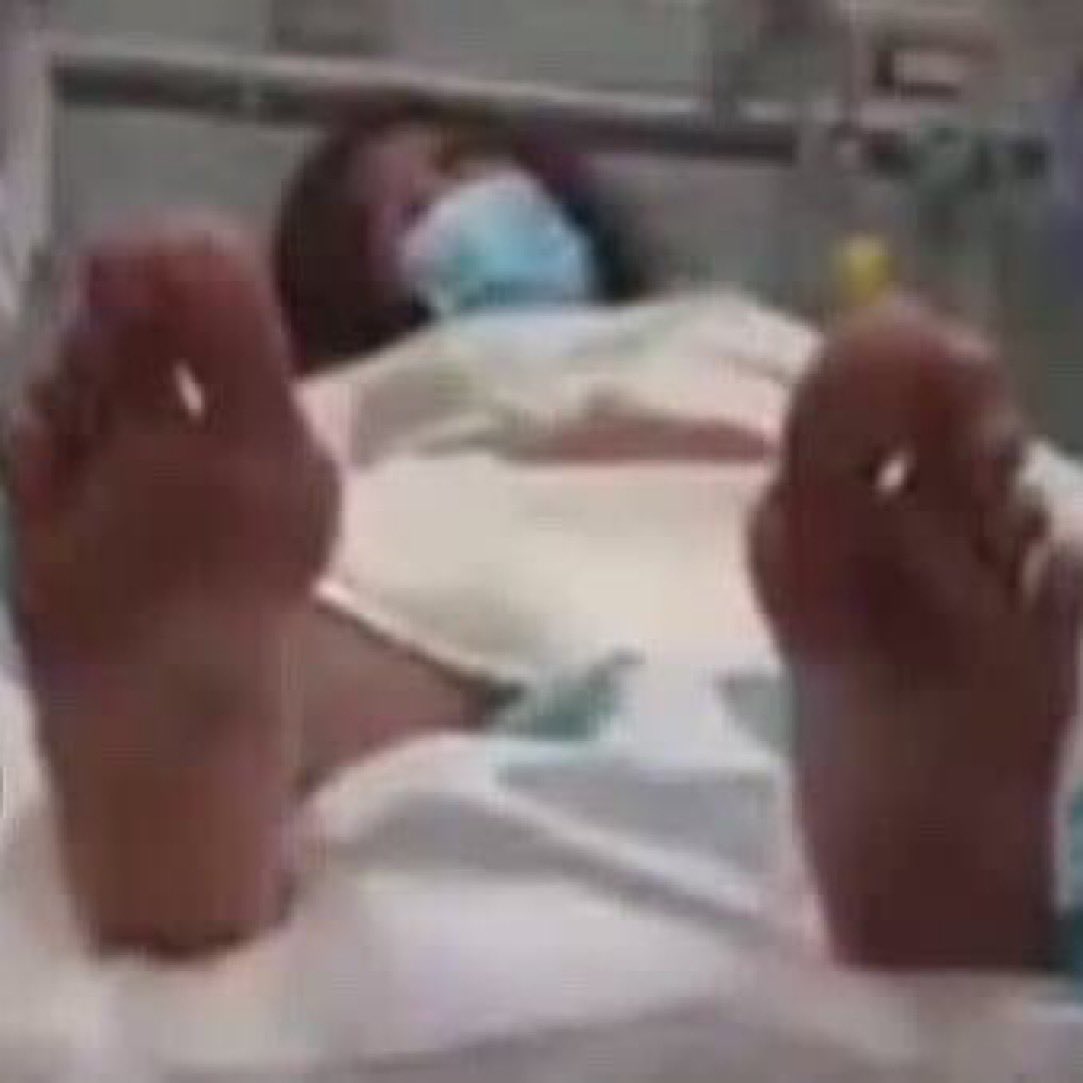 No gunshot in any foot