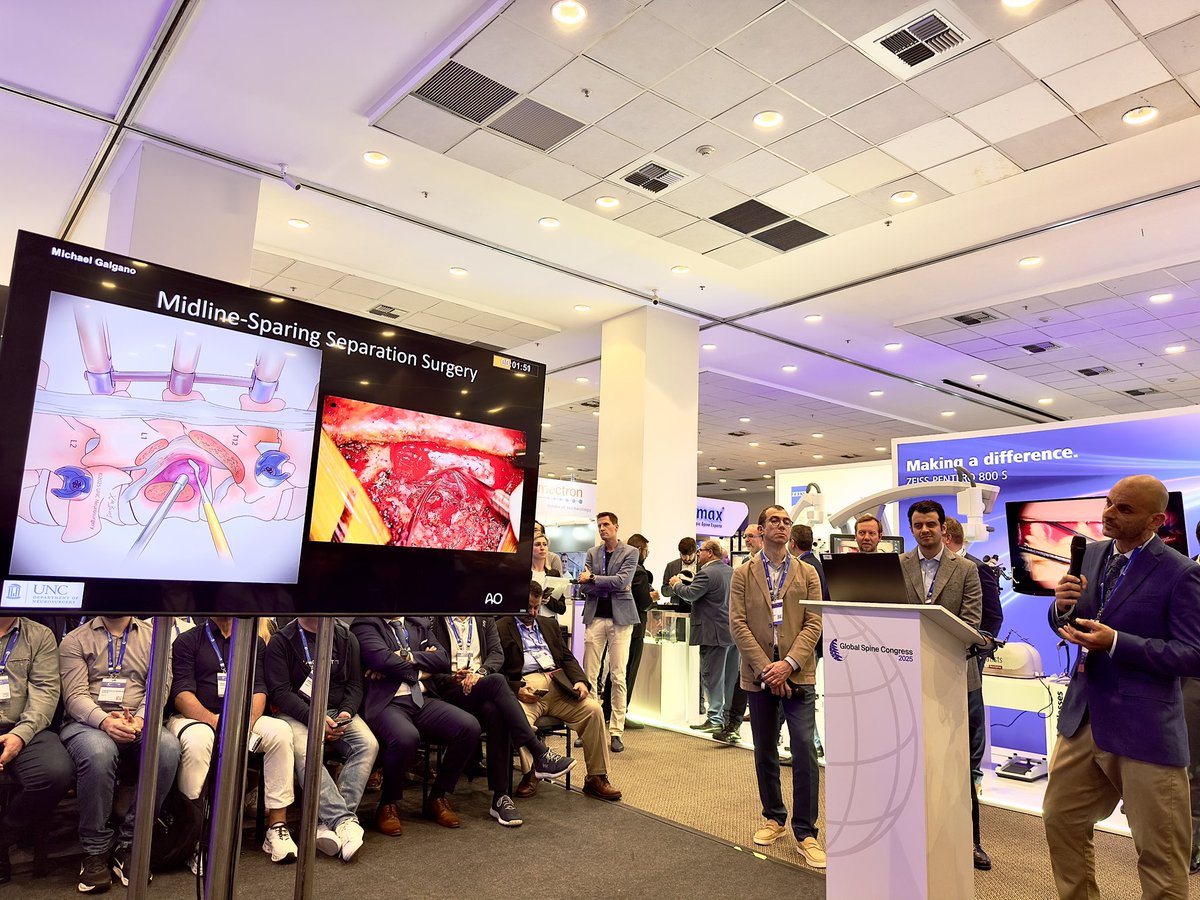 oliviagil7's tweet image. Wonderful talks this morning from @MGalganoMD and the rest of the @AOSpine tumor knowledge forum at Global Spine Congress
As always, beautiful illustrations from @BolesXian
@UNCneurosurgery #GSCRio2025