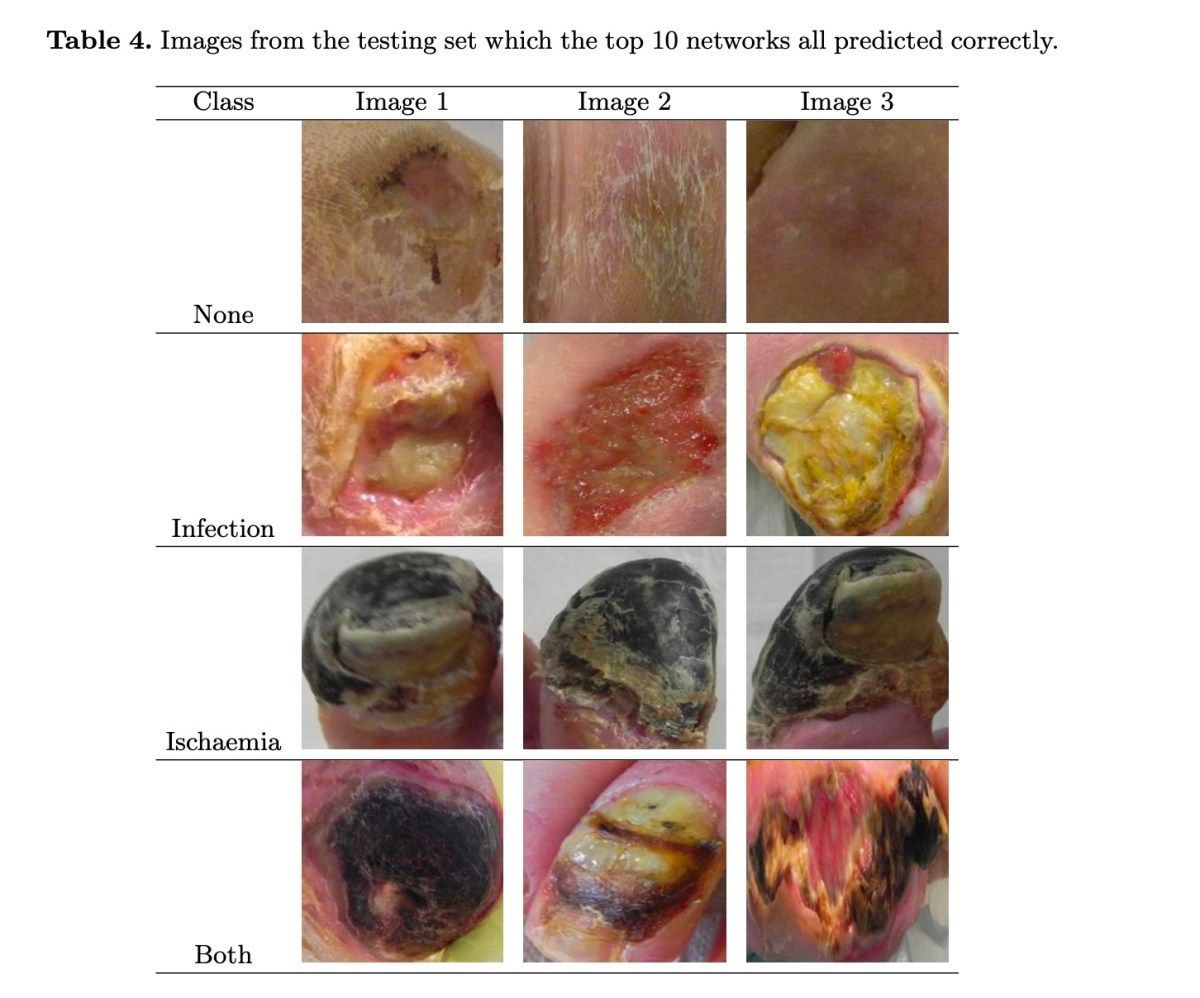David G. Armstrong follow @dgarmstrong.bsky.social (@dgarmstrong) on Twitter photo Diabetic Foot Ulcer Grand Challenge 2021: Evaluation and Summary #DiabeticFoot #GrandChallenge #ActAgainstAmputation #AI #DeepLearning <a href="/NSF/">U.S. National Science Foundation</a> @NIDDK diabeticfootonline.com/2021/11/23/dia… diabeticfootonline.com/2021/11/23/dia… Diabetic Foot Ulcer Grand Challenge 2021: Evaluation and Summary #DiabeticFoot #GrandChallenge #ActAgainstAmputation #AI #DeepLearning <a href="/NSF/">U.S. National Science Foundation</a> @NIDDK diabeticfootonline.com/2021/11/23/dia… diabeticfootonline.com/2021/11/23/dia…