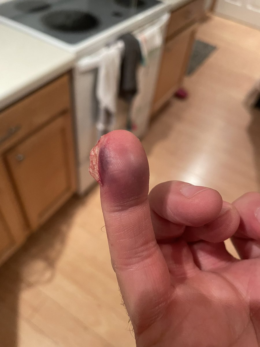 Blocked a shot tonight…