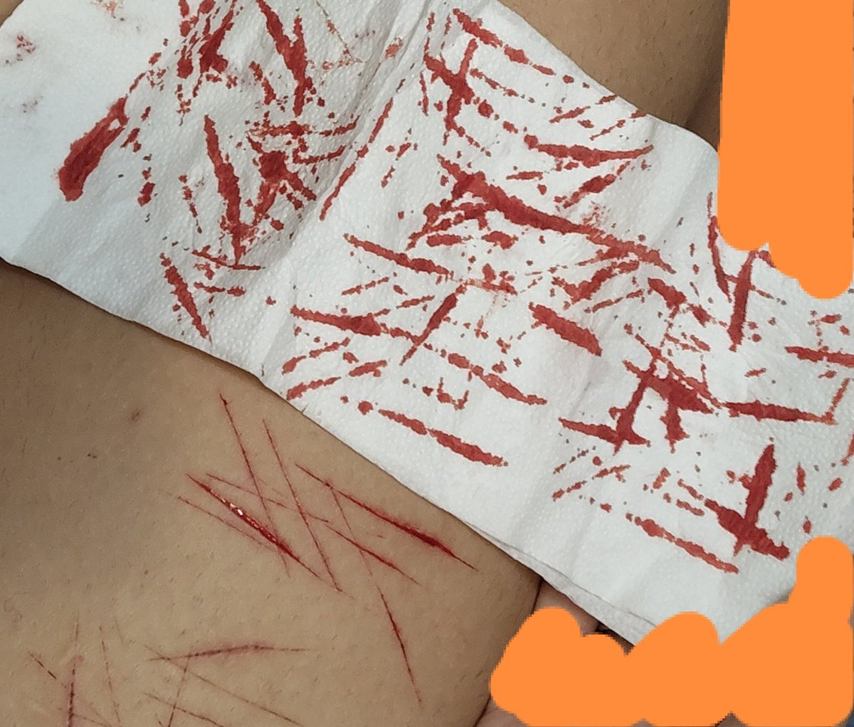 muertecitoss's tweet photo. y esta wea cuando para para ponerme el pijama q tengo frío #sh https://t.co/EiMv359MqJ