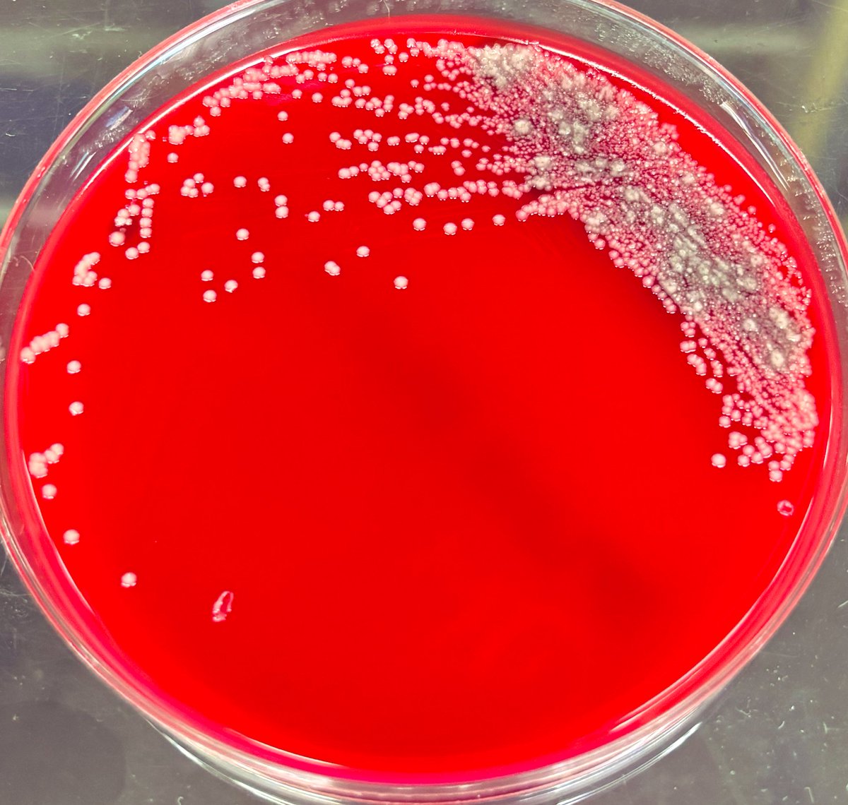 candyca88328815's tweet photo. M. catarrhalis  H. influenzae  S. pneumoniae  小児鼻腔　M. cata肺炎は市中肺炎が多く,発熱,咳嗽,喀痰,呼吸困難等の症状を伴う。成人慢性肺疾患（COPD等)患者に,気管支炎,肺炎等、小児〜成人までの年齢層で,中耳炎,副鼻腔炎等を起こす。重症化の可能性があり高齢者,免疫低下者で注意が必要。 https://t.co/FA8CXnEgF4