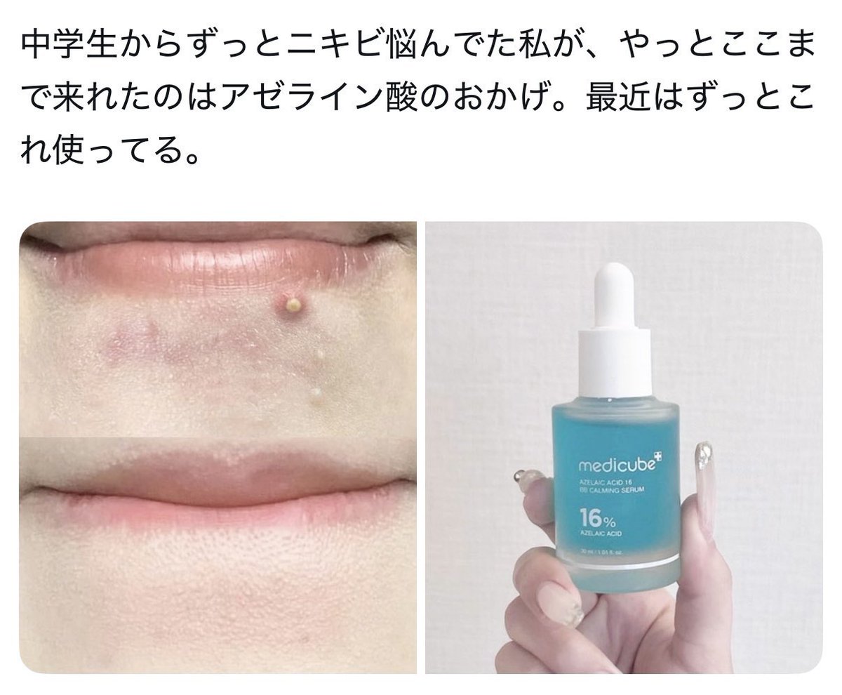 biyoutanaka's tweet photo. これガチ。皮膚科の先生も腰抜かしてた。 https://t.co/r3U2ncznCG
