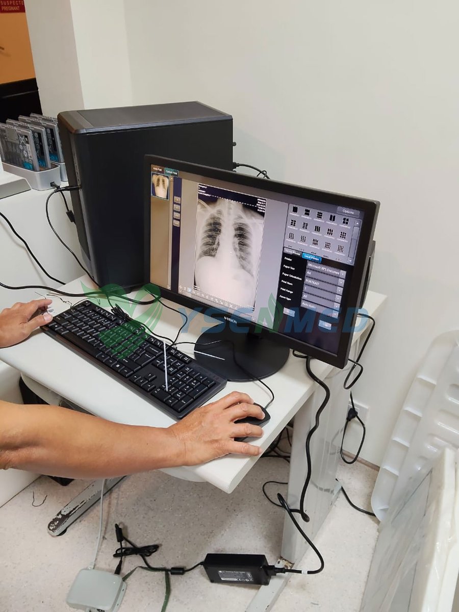 ysenmed's tweet photo. Doctor Jnueva from Philippines highly approves the image quality by YSENMED YSFPD-V1717X flat panel detector.
#ysenmed #Medicalequipment #medicalsupplier #doctor #xraysystem #flatpaneldetector
https://t.co/ux04VMbJDn https://t.co/blTwv56C3L