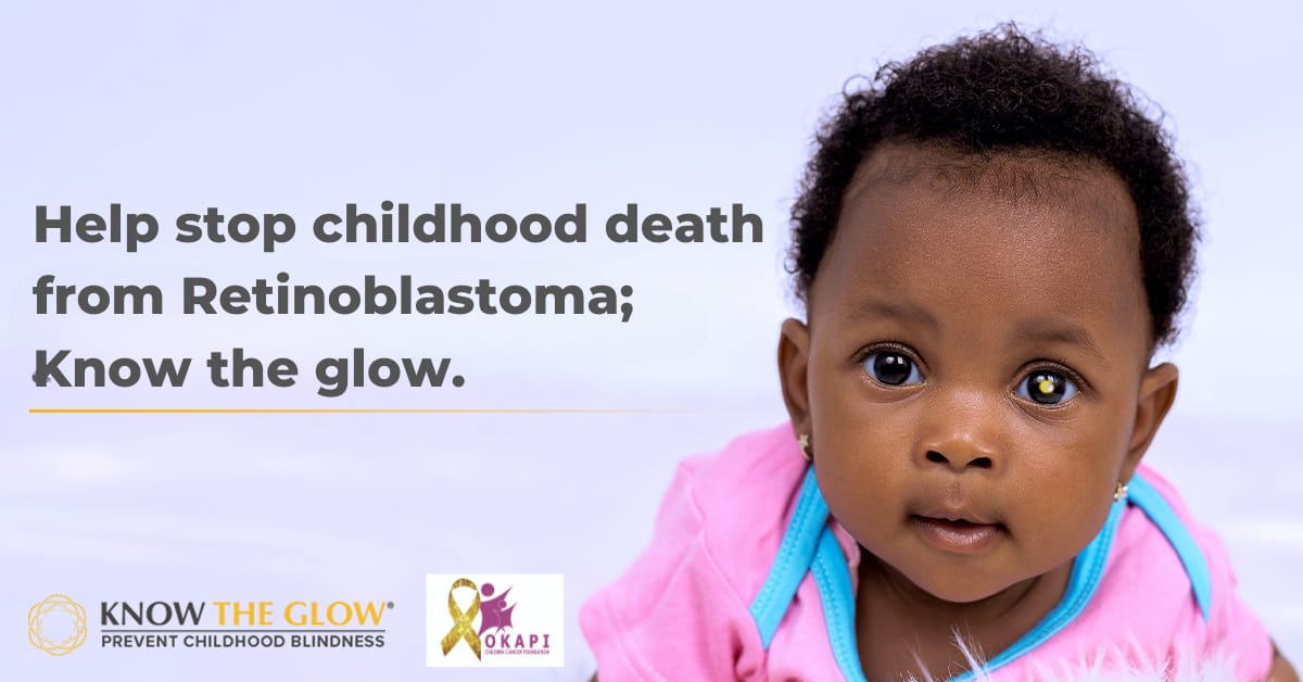 Okapi Children Cancer Foundation (@okapiccf) on Twitter photo OKAPICCF Friday Awareness
All May, weโve shared lifesaving tips with <a href="/knowtheglow/">KnowTheGlow</a> on Retinoblastomaโa rare eye cancer in kids under 5.
๐ธ A white/yellow glow in photos could be a sign. LOOK OUT FOR THR SIGN
Act early. Spread the word. Save a life.
#KnowTheGlow #Okapiccf OKAPICCF Friday Awareness
All May, weโve shared lifesaving tips with <a href="/knowtheglow/">KnowTheGlow</a> on Retinoblastomaโa rare eye cancer in kids under 5.
๐ธ A white/yellow glow in photos could be a sign. LOOK OUT FOR THR SIGN
Act early. Spread the word. Save a life.
#KnowTheGlow #Okapiccf