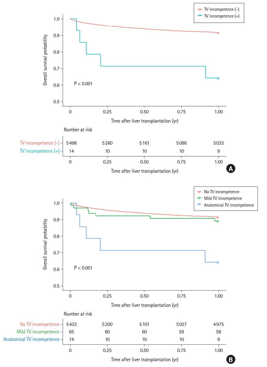 Korean Journal of Anesthesiology (KJA) (@korean_j_anesth) on Twitter photo Primary tricuspid regurgitation is not benign. Our study shows that even without pulmonary hypertension, anatomical TV incompetence significantly worsens liver transplant outcomes. Liver transplant evaluation must not overlook this subtle cardiac danger.
doi.org/10.4097/kja.24… Primary tricuspid regurgitation is not benign. Our study shows that even without pulmonary hypertension, anatomical TV incompetence significantly worsens liver transplant outcomes. Liver transplant evaluation must not overlook this subtle cardiac danger.
doi.org/10.4097/kja.24…