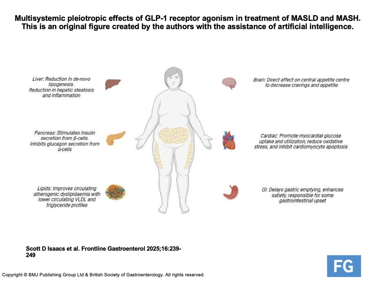 Frontline Gastro (@frontgastro_bmj) on Twitter photo ✨ 🆕 #FGPodcast 🚨 alert ➡️ 👂Check out <a href="/OTavabie/">Oliver Tavabie</a> interview <a href="/scottisaacsmd/">Scott Isaacs</a> ➕ <a href="/brennap9/">Paul Brennan</a> on the "Role of anti-diabetic medications in the management of MASLD" 🔗 Link to 📻 #FGPodcast ⬇️ and relevant article 📰 bit.ly/3FALQDe
▶️ Apple: apple.co/3SXaUr5
▶️ ✨ 🆕 #FGPodcast 🚨 alert ➡️ 👂Check out <a href="/OTavabie/">Oliver Tavabie</a> interview <a href="/scottisaacsmd/">Scott Isaacs</a> ➕ <a href="/brennap9/">Paul Brennan</a> on the "Role of anti-diabetic medications in the management of MASLD" 🔗 Link to 📻 #FGPodcast ⬇️ and relevant article 📰 bit.ly/3FALQDe
▶️ Apple: apple.co/3SXaUr5
▶️