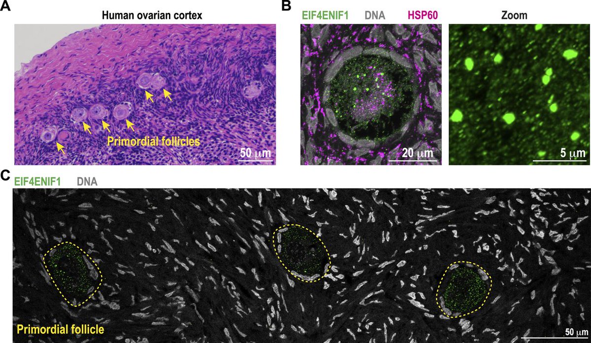 Bhatia et al. use female nematodes to reveal how the conserved eIF4E-Transporter protein (eIF4ET) plays an unexpected role in promoting translation of cytoskeletal proteins to support days-long storage of arrested oocytes life-science-alliance.org/content/8/8/e2…