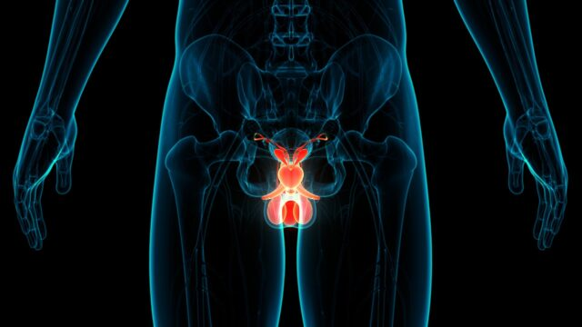 El acceso, principal desafío en España en la terapia con radioligandos para cáncer de próstata mestastásico resistente a tratamiento.El Dr. Adolfo Gómez, del Hospital 12 de Octubre, destaca la eficacia de los radioligandos en cáncer de próstata
isanidad.com/332137/el-acce…