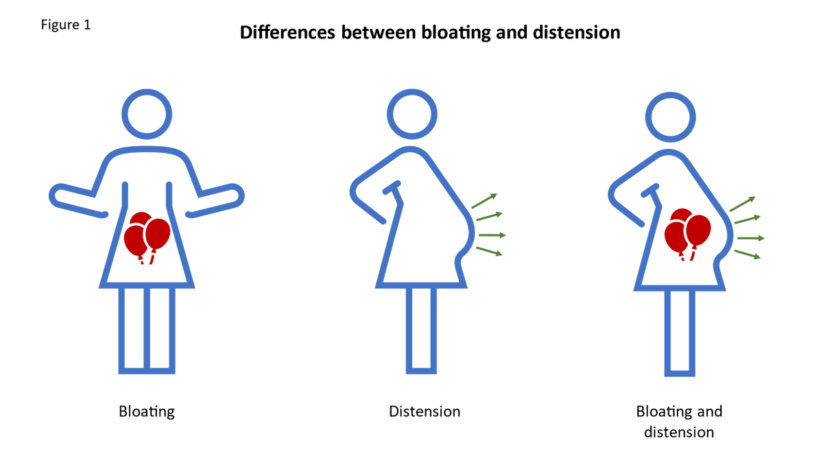 Bloating is one of the most frequently reported symptoms in #gastroenterology consultations.

Our latest Web Education article focuses on the management of bloating following the case of a 54-year-old woman 👉 ow.ly/U3U750W0J1X