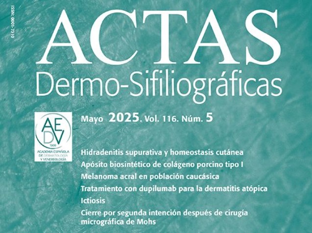 🗣️ ¡Ya puedes leer el número de mayo de Actas Dermo-Sifiliográficas! 👇
actasdermo.org/es-vol-116-num…

✅ Hidradenitis y homeostasis cutánea
✅ Apósito biosintético
✅ Melanoma acral en caucásicos
✅ Dupilumab en DA
✅ Ictiosis
✅ Mohs y cierre por 2ª intención

¡No te lo pierdas!👀📚