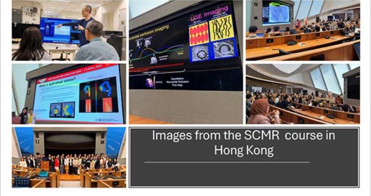 Vass Vassiliou (@vass_vassiliou) on Twitter photo Protons 🧲 the <a href="/SCMRorg/">Society for Cardiovascular Magnetic Resonance</a> May NewsBeat is out! Find it here: multibriefs.com/briefs/SCMR/SC…
Importantly - u r views COUNT!
Tell us what u think of the NewsBeat content 👇
tinyurl.com/877j59a2
Read about conferences, efucational events, our SCMR directory centers & more! #whycmr Protons 🧲 the <a href="/SCMRorg/">Society for Cardiovascular Magnetic Resonance</a> May NewsBeat is out! Find it here: multibriefs.com/briefs/SCMR/SC…
Importantly - u r views COUNT!
Tell us what u think of the NewsBeat content 👇
tinyurl.com/877j59a2
Read about conferences, efucational events, our SCMR directory centers & more! #whycmr