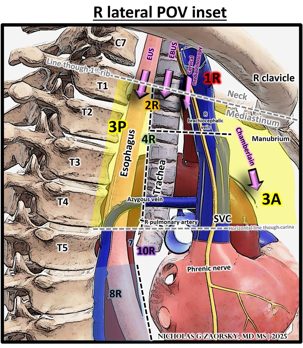 NicholasZaorsky's tweet photo. Lymph node stations of the thorax

Illustration based on @IASLC @UMichiganNews anatomic guides https://t.co/CgS3kGgwgD