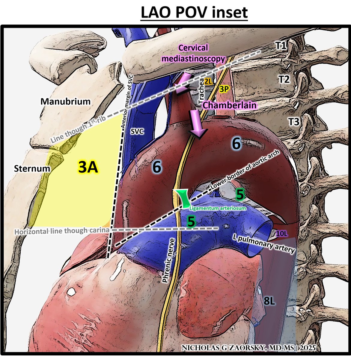 NicholasZaorsky's tweet photo. Lymph node stations of the thorax

Illustration based on @IASLC @UMichiganNews anatomic guides https://t.co/CgS3kGgwgD