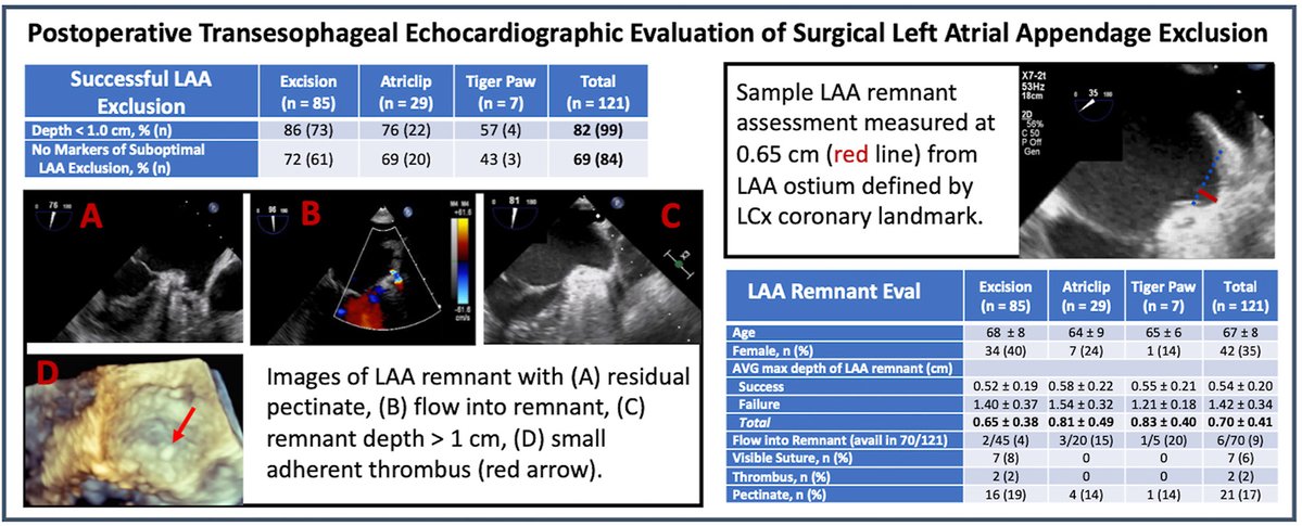 Structural Heart (@crfshj) on Twitter photo 🔍 New study evaluating surgical LAA exclusion using post-op TEE found high rate of suboptimal closure by current standards. More data needed to understand clinical impact. ow.ly/5xaI50W0Tn9 <a href="/KMRichardsonMD/">Karl Richardson</a> <a href="/KPKDhaliwal/">Karanpreet Dhaliwal, MD</a> <a href="/RoheshF/">Rohesh Fernando</a> <a href="/PrashantBhave11/">Prashant Bhave</a> <a href="/PopmaJeffrey/">Jeffrey Popma</a> 🔍 New study evaluating surgical LAA exclusion using post-op TEE found high rate of suboptimal closure by current standards. More data needed to understand clinical impact. ow.ly/5xaI50W0Tn9 <a href="/KMRichardsonMD/">Karl Richardson</a> <a href="/KPKDhaliwal/">Karanpreet Dhaliwal, MD</a> <a href="/RoheshF/">Rohesh Fernando</a> <a href="/PrashantBhave11/">Prashant Bhave</a> <a href="/PopmaJeffrey/">Jeffrey Popma</a>