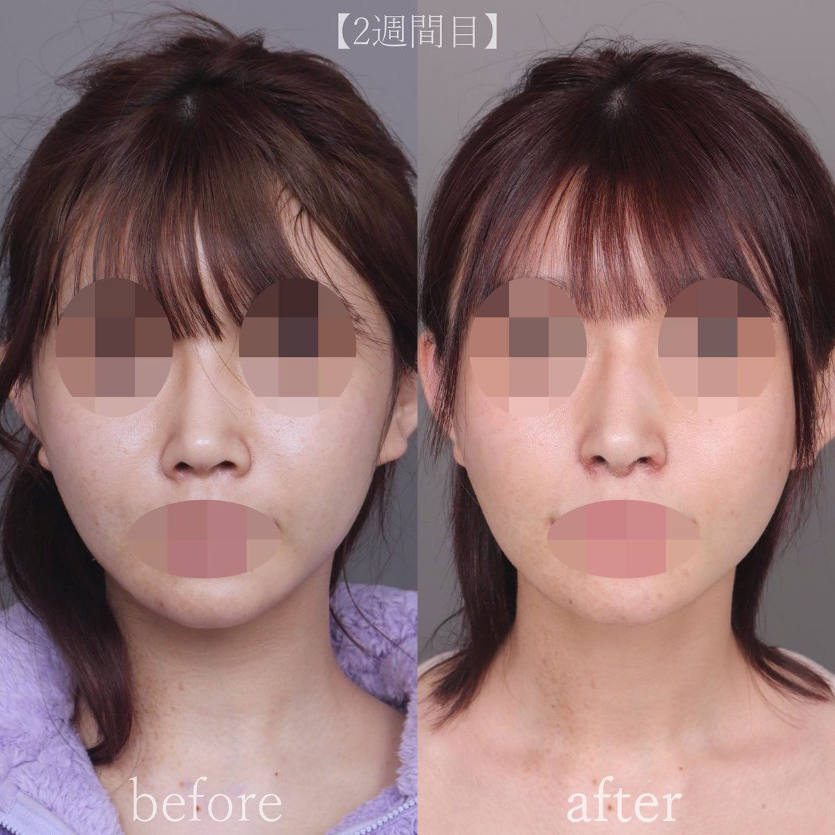 【公式】温度美容外科/ オンド美容外科 tweet media