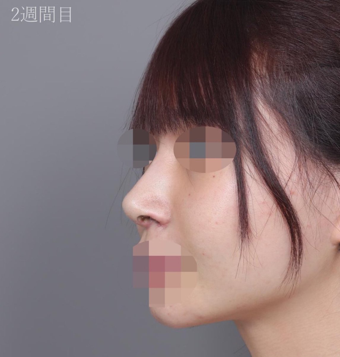 【公式】温度美容外科/ オンド美容外科 tweet media