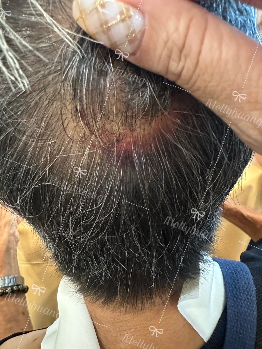 我回高雄是因為要看我90歲的媽媽，
因為她前兩天又跌倒送急診，
還好她人沒事，
帶了媽媽去外面吃午餐，
下午陪她聊聊天。

晚上就自己跟主人在高雄放鬆的時間，
高雄順眼的單男時間都配合不上😓
那麼晚上就要無聊了🤣
我應徵單男是有條件的，
條件都在我版面的文章。

#轉推愛心❤️