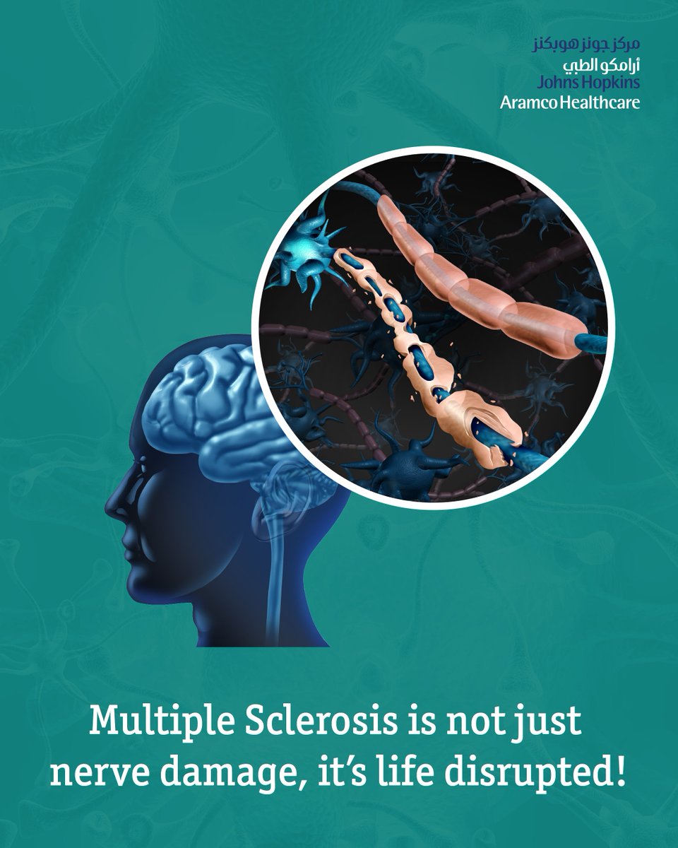 JHopkinsSaudi's tweet photo. Multiple Sclerosis (MS) is more than nerve damage, it’s a condition that disrupts the body’s ability to communicate with itself.  

In MS, the protective covering around nerve fibers is damaged, leading to misfired or blocked signals between the brain and the body. This disruption can affect movement, vision, and daily functioning.  

While there's no cure for MS, early diagnosis and treatment can help manage symptoms and slow the progression of the disease.  

Visit the link to learn more and talk to our Neurology experts: https://t.co/MlnCLw7BAx  

#JHAH #JohnsHopkinsAramcoHealthcare