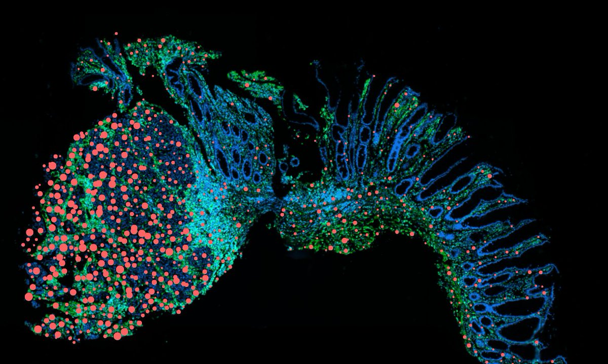 Neue Perspektive für Patient:innen mit chronisch-entzündlichen Darmerkrankungen: Forschende der #CharitéBerlin entdecken einen Therapieansatz, der Entzündungen &amp; Krebsrisiko bei #MorbusCrohn &amp; #ColitisUlcerosa gezielt senken könnte. Mehr @NatureImmunol. charite.de/service/presse…