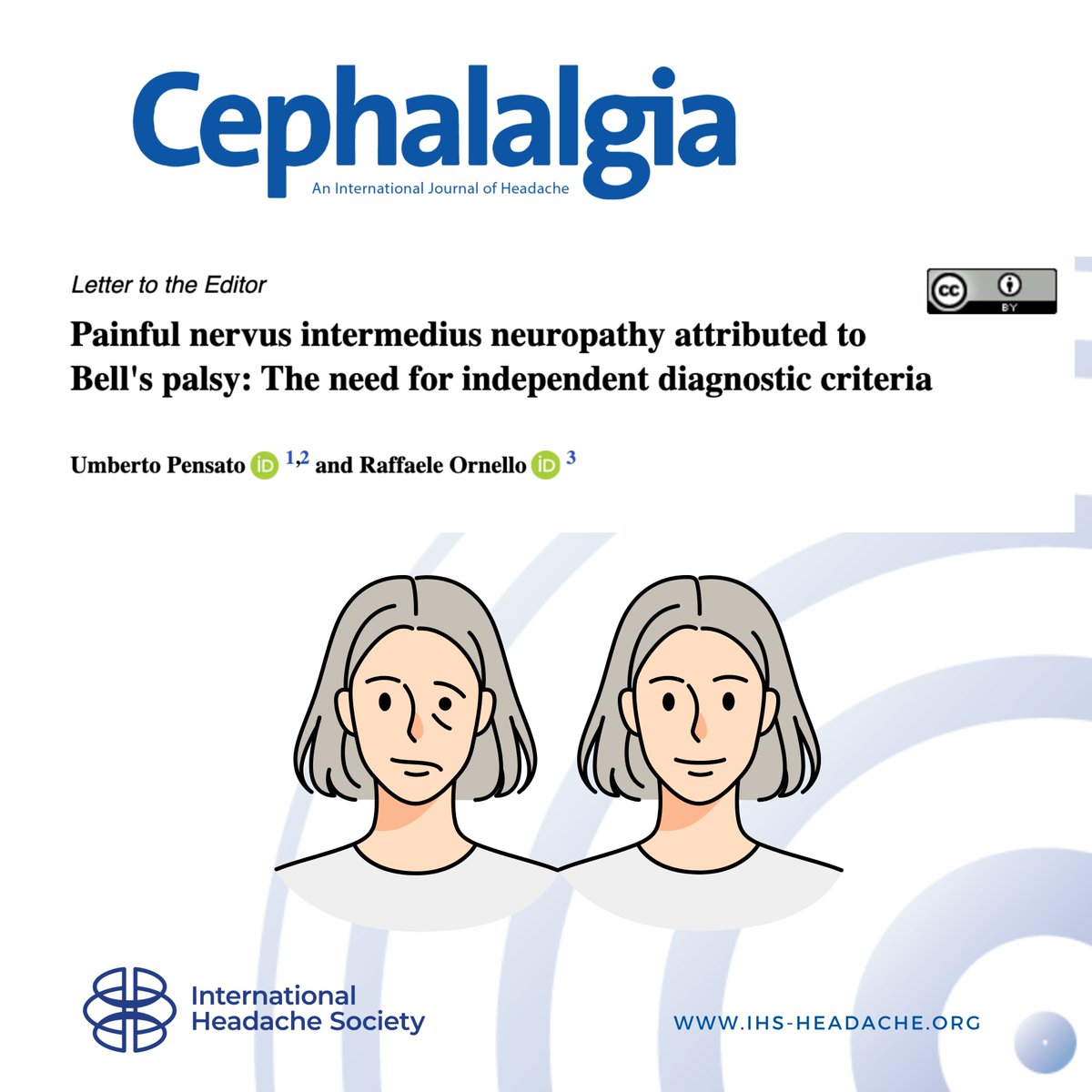 This study proposes the inclusion of formal diagnostic criteria for painful nervus intermedius neuropathy attributed to Bell’s Palsy, which is an under-recognized yet clinically relevant feature of this condition.
journals.sagepub.com/doi/10.1177/03…
#headache #brain #pain #neurology