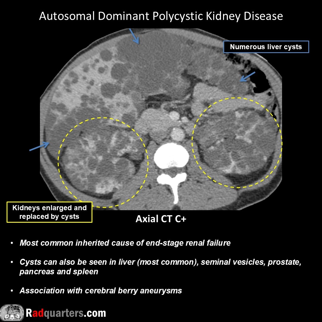 Radquarters's tweet image. #FOAMrad #FOAMed #radiology #radres #radtech #medstudent #radquarters