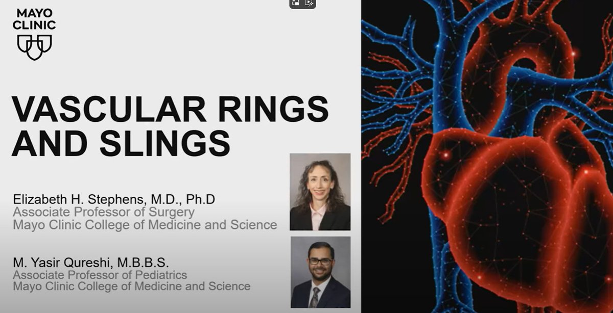 Mayo Clinic Cardiac Surgery (@mayocliniccvs) on Twitter photo In this <a href="/MayoClinicCV/">Mayo Clinic CV</a> webinar, <a href="/EHStephensCHD/">Elizabeth Stephens, MD, PhD</a> & Y. Quereshi MD review the major type of vascular rings & slings, recognize appropriate work-up as part of a diagnosis & understand aspects to surgical repair strategies & how they can be age-dependent.
bit.ly/4jnZM1v In this <a href="/MayoClinicCV/">Mayo Clinic CV</a> webinar, <a href="/EHStephensCHD/">Elizabeth Stephens, MD, PhD</a> & Y. Quereshi MD review the major type of vascular rings & slings, recognize appropriate work-up as part of a diagnosis & understand aspects to surgical repair strategies & how they can be age-dependent.
bit.ly/4jnZM1v