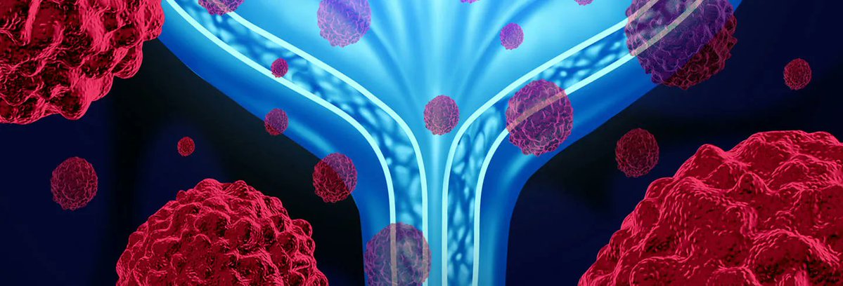College of Medicine and Health (UoB) (@unibirm_cmh) on Twitter photo At the end of #BladderCancerAwarenessMonth, find out more about our <a href="/unibirmingham/">Uni of Birmingham</a> Bladder Cancer Research Centre. Our research team improve the lives of patients by reducing diagnosis time and invasive tests, and develop new drugs and surgical approaches. birmingham.ac.uk/research/centr… At the end of #BladderCancerAwarenessMonth, find out more about our <a href="/unibirmingham/">Uni of Birmingham</a> Bladder Cancer Research Centre. Our research team improve the lives of patients by reducing diagnosis time and invasive tests, and develop new drugs and surgical approaches. birmingham.ac.uk/research/centr…