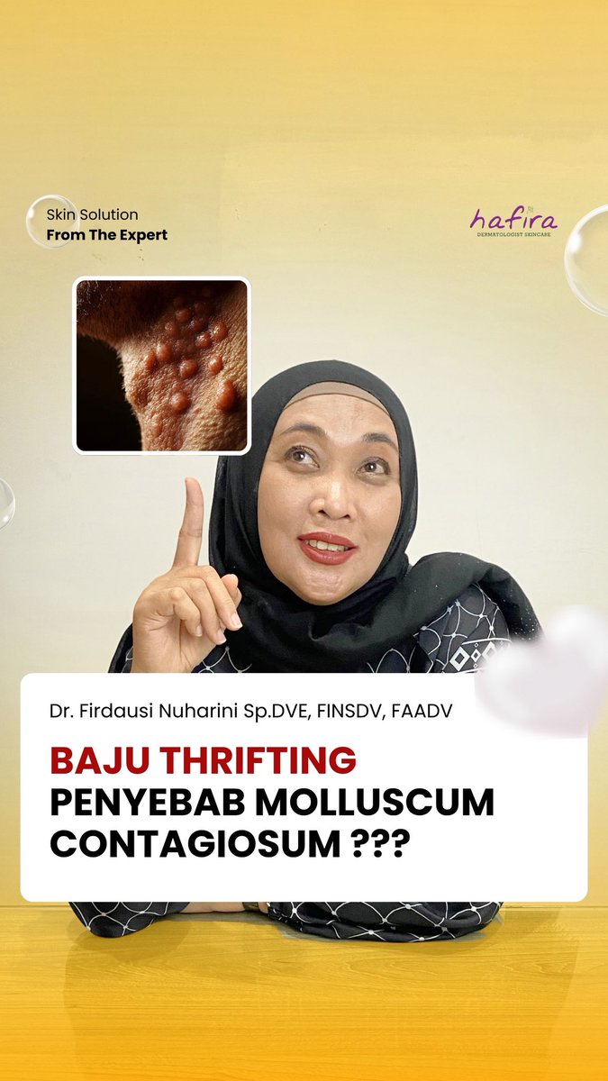 HafiraSkincare's tweet image. BAJU THRIFTING PENYEBAB MOLLUSCUM CONTAGIOSUM ???

Baru-baru ini ada yang lagi viral.
Apakah mungkin??
Yuk simak video edukasinya
Bagi kalian yang mau bertanya, silahkan koment …

#molluscumcontagiosum #bajuthrift #bajuthrifting #penyakitvirus #dokterkulitfirda #hafiraskincare