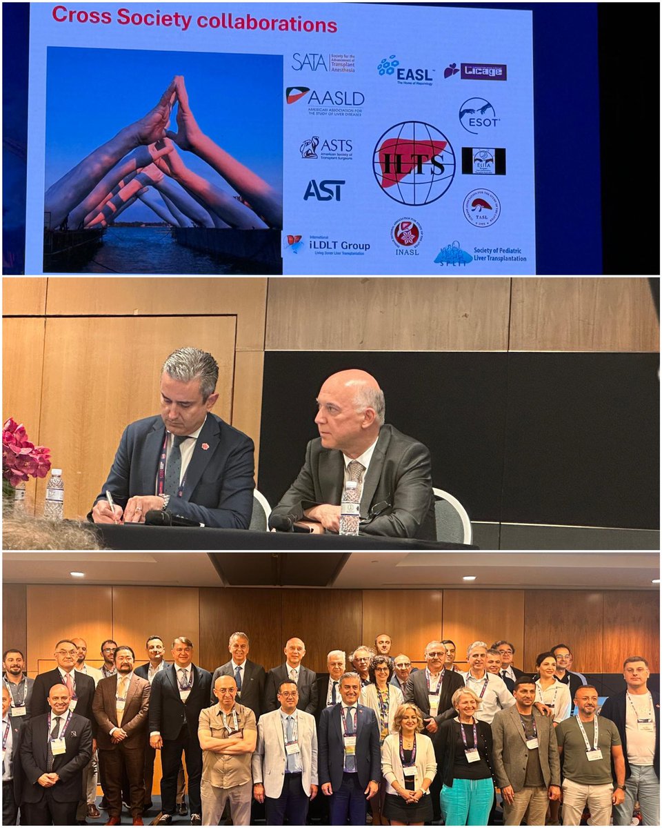 28-31 Mayıs 2025 tarihlerinde Singapur’da düzenlenen International Liver Transplantation Society (ILTS) 2025 Kongresi, “Liver Transplantation’da Geleceği Şekillendiren Yenilikler” temasıyla bu yıl da dünya çapında ses getirdi.
