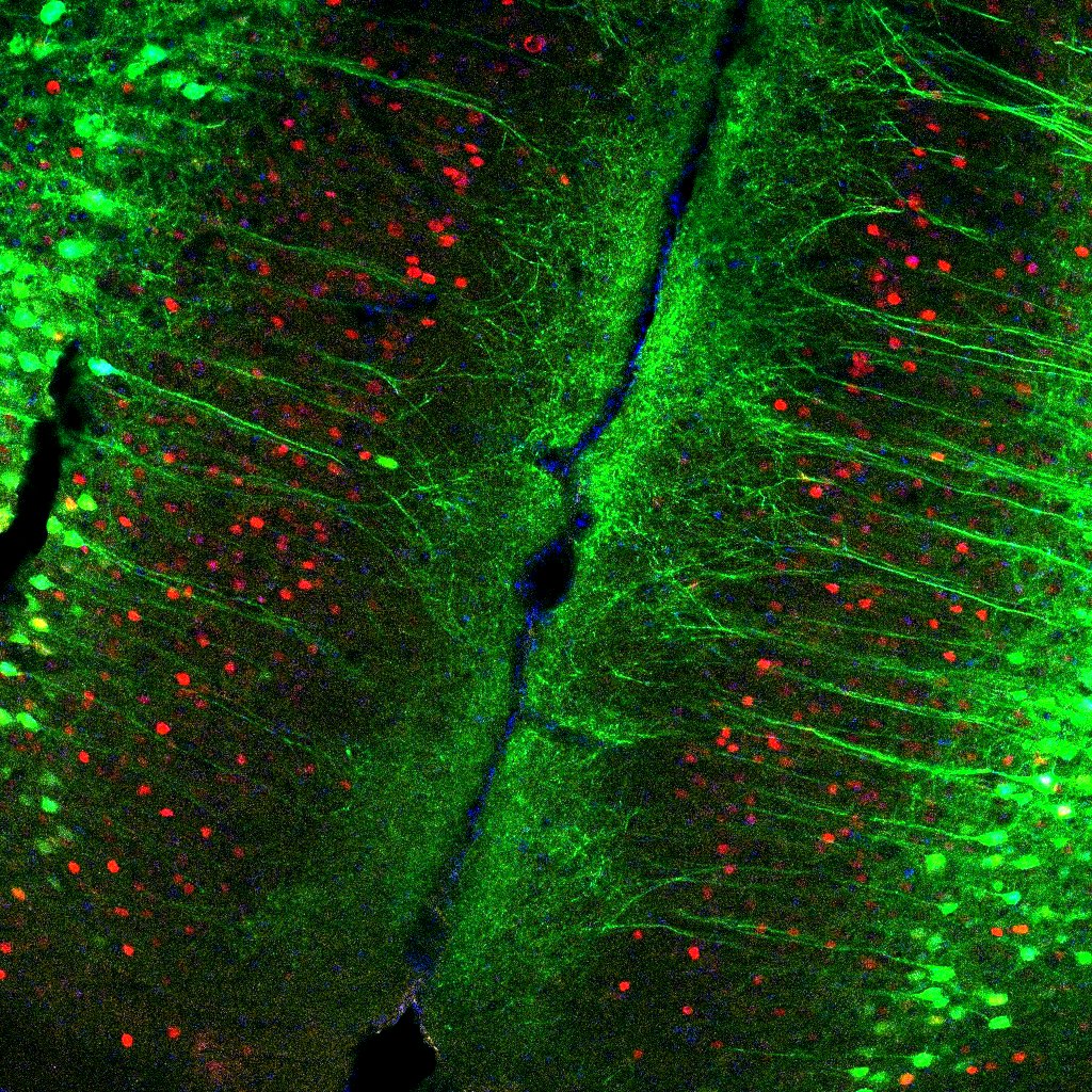 Friedman Brain Institute (@sinaibrain) on Twitter photo .<a href="/DierdorffLauren/">Lauren Dierdorff</a>'s stunning image "The Edge"! Immunohistochemistry antibody labelling of adult mouse cortex💚fluorescing neurons are corticopontine neurons expressing viral GFP &❤️cells are c-Fos expressing cells indicating neural activation. .<a href="/DierdorffLauren/">Lauren Dierdorff</a>'s stunning image "The Edge"! Immunohistochemistry antibody labelling of adult mouse cortex💚fluorescing neurons are corticopontine neurons expressing viral GFP &❤️cells are c-Fos expressing cells indicating neural activation.