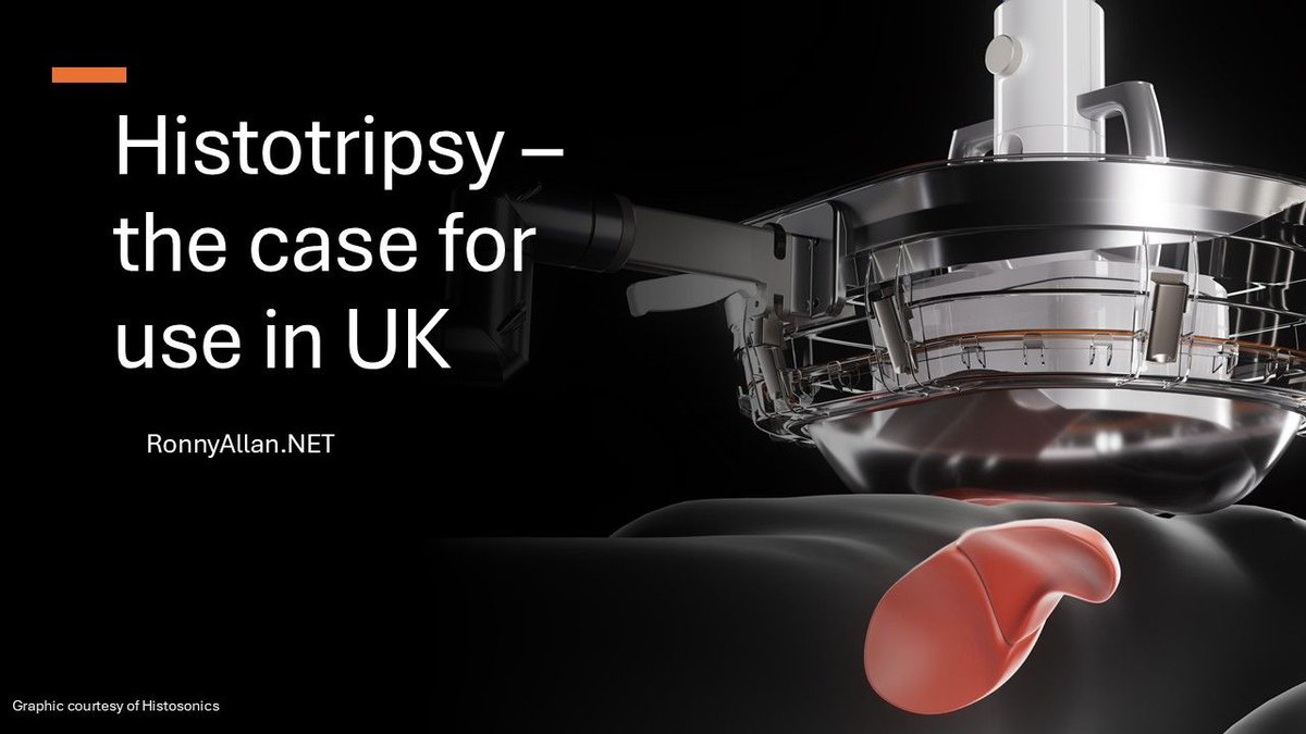 Ronny Allan (@ronnyallan1) on Twitter photo Histotripsy ā the case for use in UK as <a href="/histosonics/">Histosonics Inc.</a> has been awarded early market access buff.ly/MAE18rv Histotripsy ā the case for use in UK as <a href="/histosonics/">Histosonics Inc.</a> has been awarded early market access buff.ly/MAE18rv