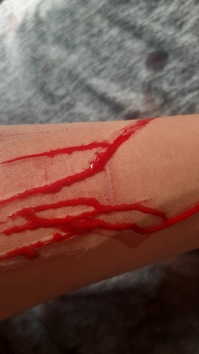LexKilll's tweet photo. my scars

#shtwt https://t.co/I2gpGshCbL