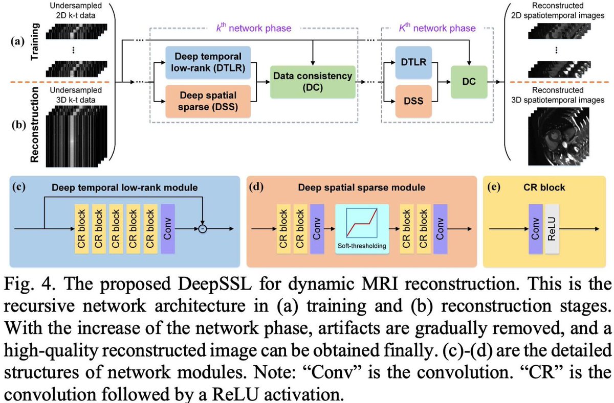 gyangMedIA's tweet image. 🚀 Breaking barriers in fast dynamic MRI with DeepSSL

Our physics-informed, separable learning approach boosts training data ~200× 📈 &amp;amp; excels with 75% less data

Revolutionizing #MRI with less data, more power💡🧠
🔗 lnkd.in/ePt-36XH

#FastMRI #DeepLearning #MedicalImage