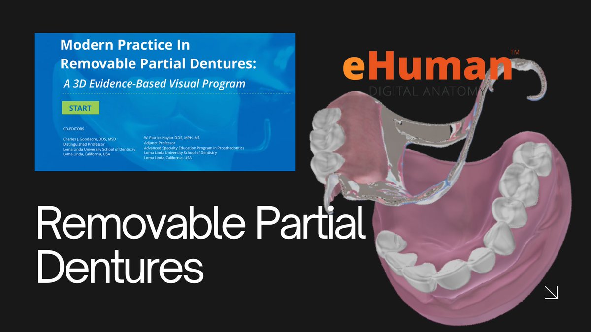 eHuman's tweet photo. Introducing the Ultimate Resource for Removable Partial Dentures

Discover the first-ever “3D Interactive RPD Program”—an innovative learning experience that simulates the placement and removal of various RPD designs on a cast. 

Try it FREE for 2 weeks

Contact sales@ehuman.com https://t.co/ctKo6eALG4