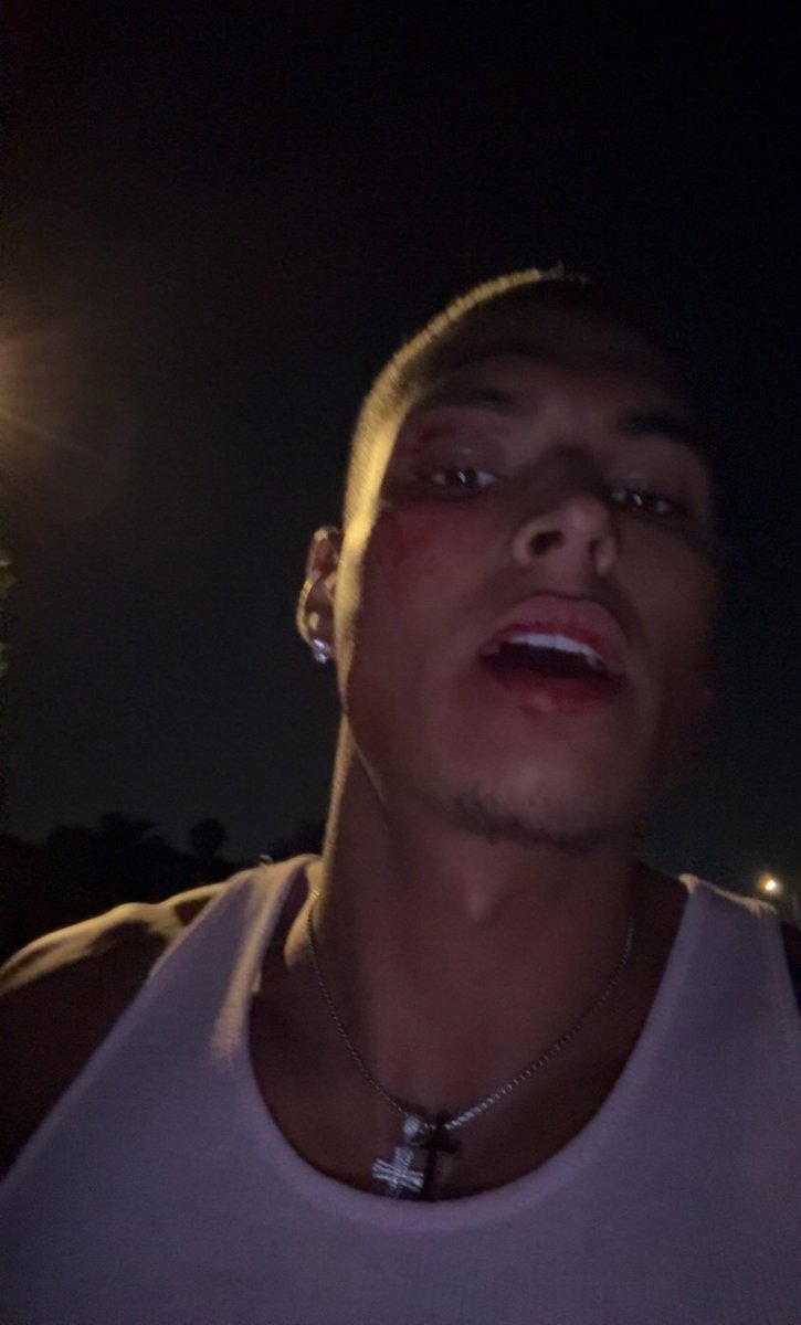 Twitch Streamer Marlon was attacked by 4 people while he was going out to get something at night 😳