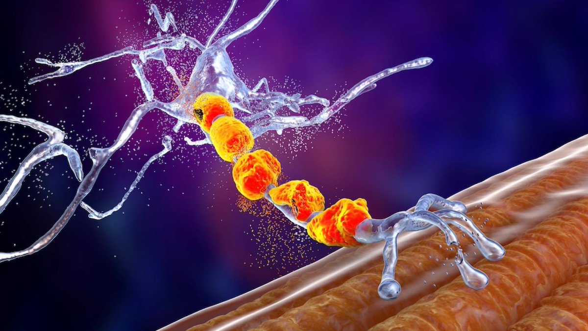 UK Dementia Research Institute (@ukdri) on Twitter photo Scientists from <a href="/adrianisaacslab/">Adrian Isaacs Lab</a> (UK DRI at UCL) have developed an innovative screening platform that could accelerate treatments for the most common genetic cause of frontotemporal dementia (FTD) & amyotrophic lateral sclerosis (ALS)
Read more 👉 ukdri.ac.uk/news-and-event… Scientists from <a href="/adrianisaacslab/">Adrian Isaacs Lab</a> (UK DRI at UCL) have developed an innovative screening platform that could accelerate treatments for the most common genetic cause of frontotemporal dementia (FTD) & amyotrophic lateral sclerosis (ALS)
Read more 👉 ukdri.ac.uk/news-and-event…