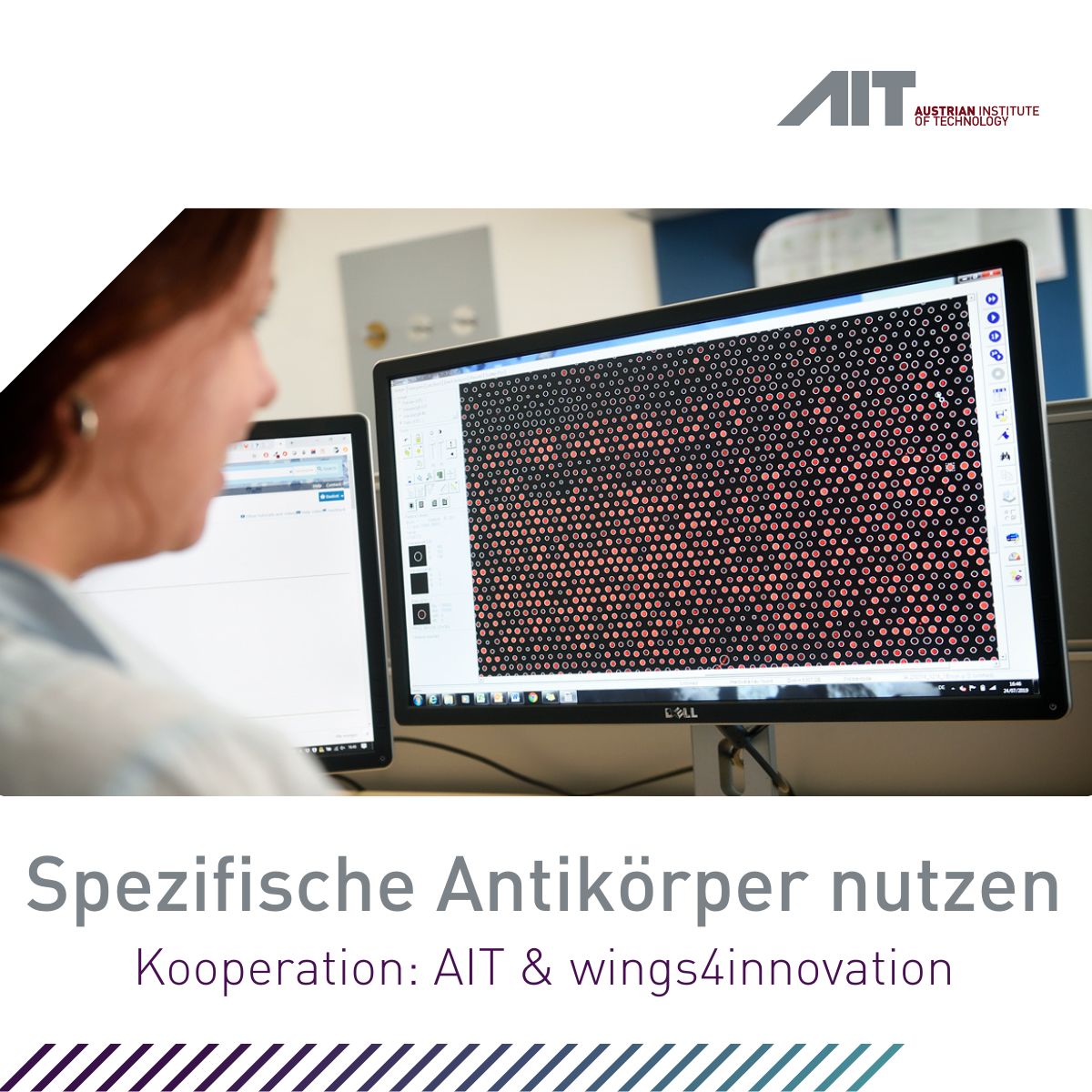 AIT &amp; wings4innovation identifizieren neue Tumor-Antigene für Krebsimmuntherapien.
97 Targets, 1 Lead-Molekül und jetzt ein erster, patientenbasierter Antikörper in Entwicklung – ein starkes Beispiel für erfolgreiche Forschungstranslation in Österreich. presse.ait.ac.at/news-ait-und-w…