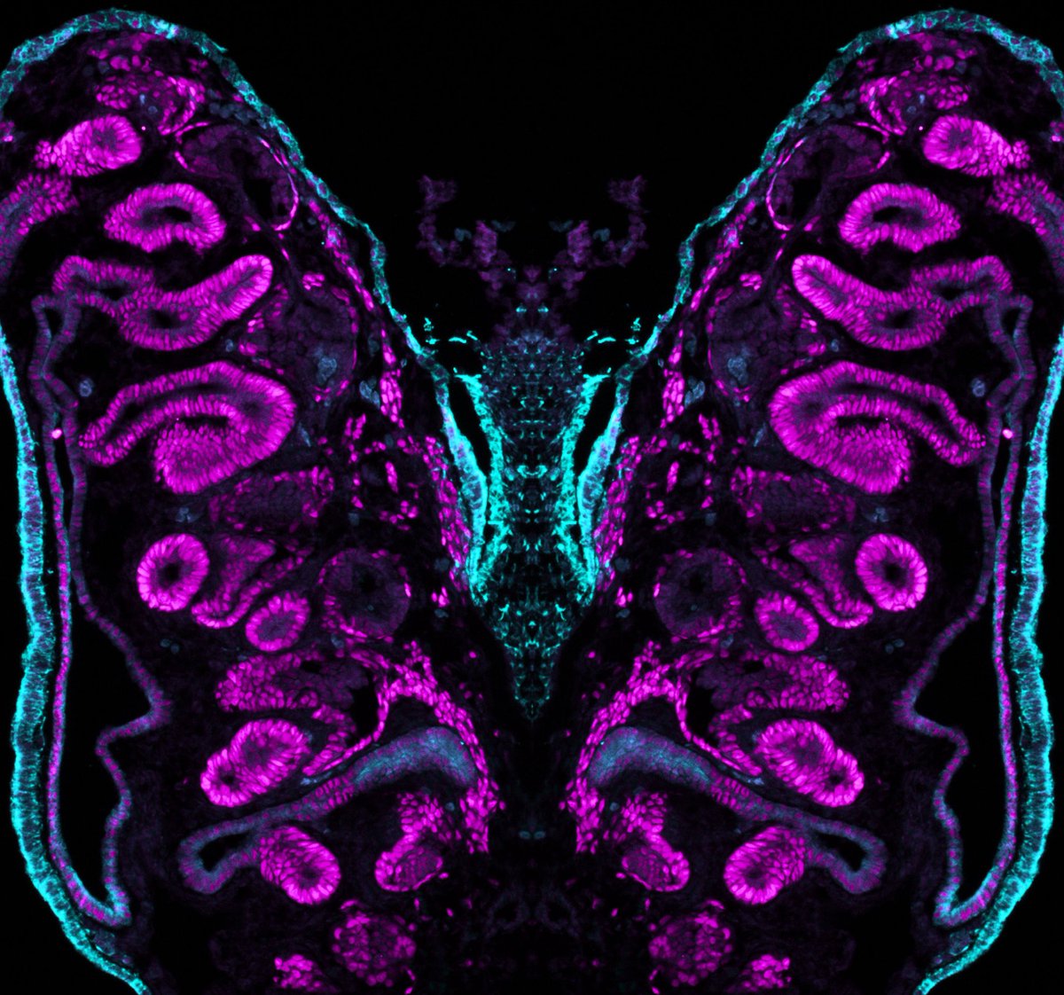 Society for Developmental Biology (@socdevbio) on Twitter photo 🦋✨ #FluorescenceFriday meets developmental biology!
This glowing "butterfly" isn't an insect, it's a transverse section of a developing chicken gonad. When art meets science, even sex differentiation takes flight! Image taken by <a href="/EstermannMartin/">Martín Estermann</a> #ChickenModel #DevBio 🐥🔬 🦋✨ #FluorescenceFriday meets developmental biology!
This glowing "butterfly" isn't an insect, it's a transverse section of a developing chicken gonad. When art meets science, even sex differentiation takes flight! Image taken by <a href="/EstermannMartin/">Martín Estermann</a> #ChickenModel #DevBio 🐥🔬