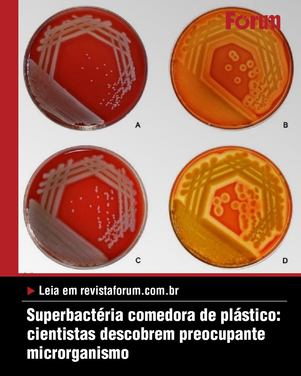 revistaforum's tweet photo. Nova mutação encontrada em paciente conseguiu degradar plástico usado em curativos
📍Leia na #Fórum: https://t.co/dkaJBWyvep
#Superbactéria #PseudomonasAeruginosa #Pap1 #Saúde #RevistaFórum https://t.co/bmLLI1E6Wj