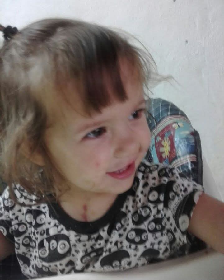 Ella es Liz,nació en Rosario,con un problema en su corazón.Los Médicos del Garrahan asistieron su nacimiento y 2 dias después fue operada en el hospital. Hicieron un milagro. Hoy nuestra niña, tiene 10 años, es patinadora y es muy feliz. 
Sigue 👇